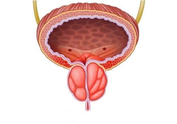 Infiammazione della prostata negli uomini