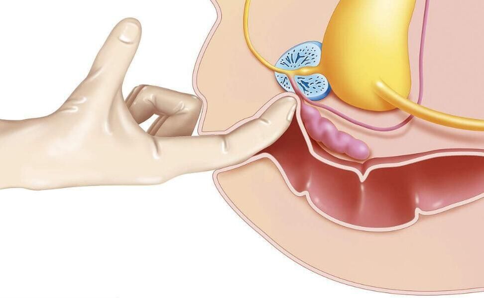 Massaggio alla prostata