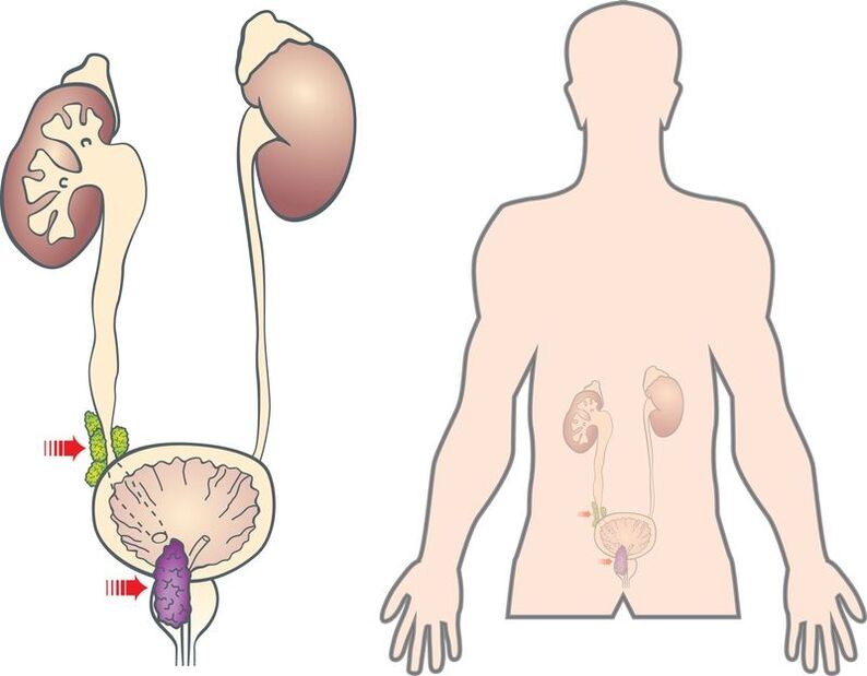 Sintomi e cause dell'adenoma prostatico