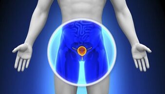 Trattamento della prostatite con farmaci