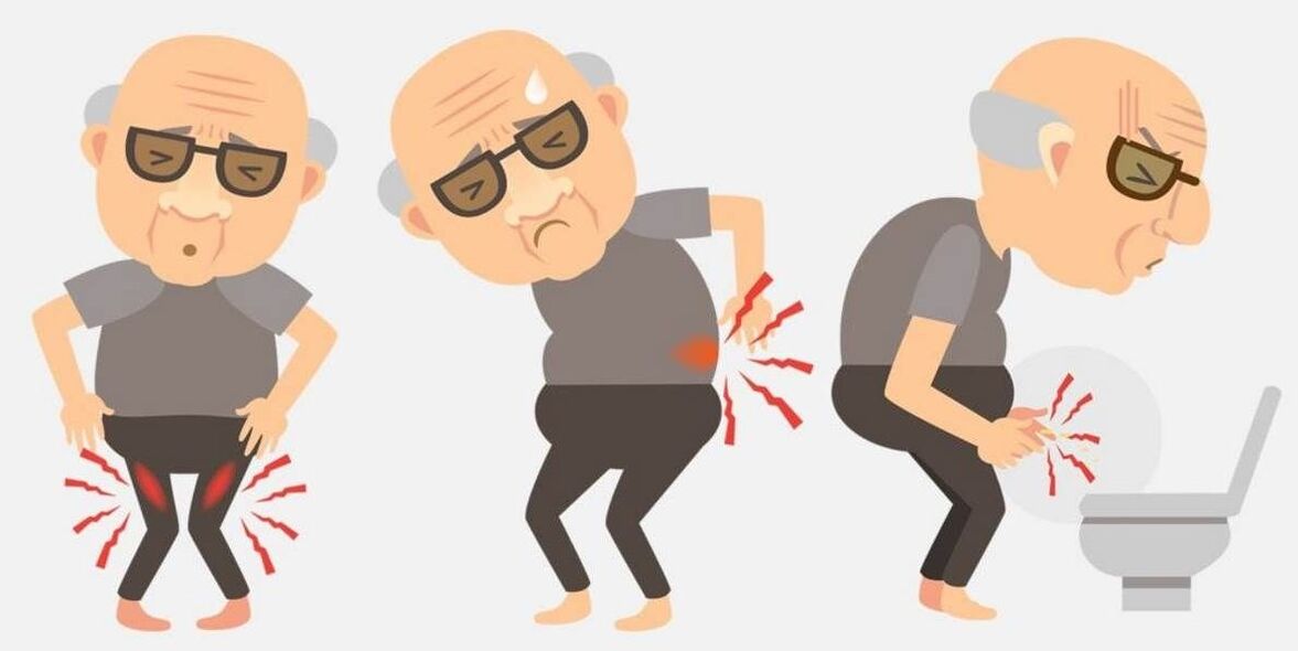 Sintomi della prostatite